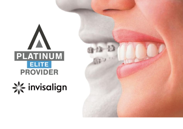 Invisalign Johor Bahru (JB) | Dental Clinic Johor Bahru (JB) | Dental Service Johor Bahru (JB)