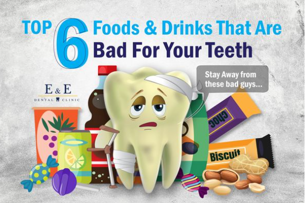 Top 6 Foods & Drinks That Are Bad For Your Teeth