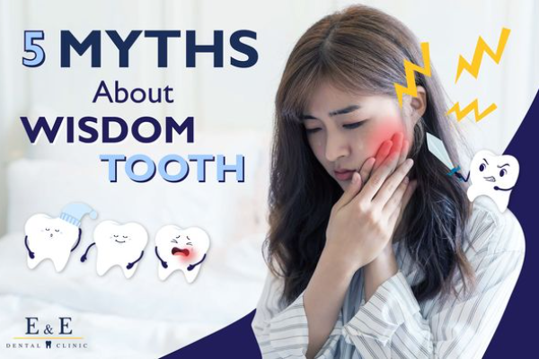 5 Myths about Wisdom Tooth