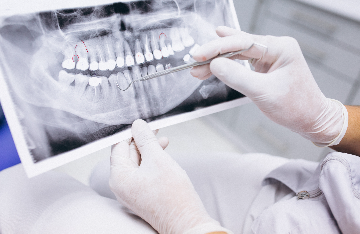 Dental Radiographic Imaging